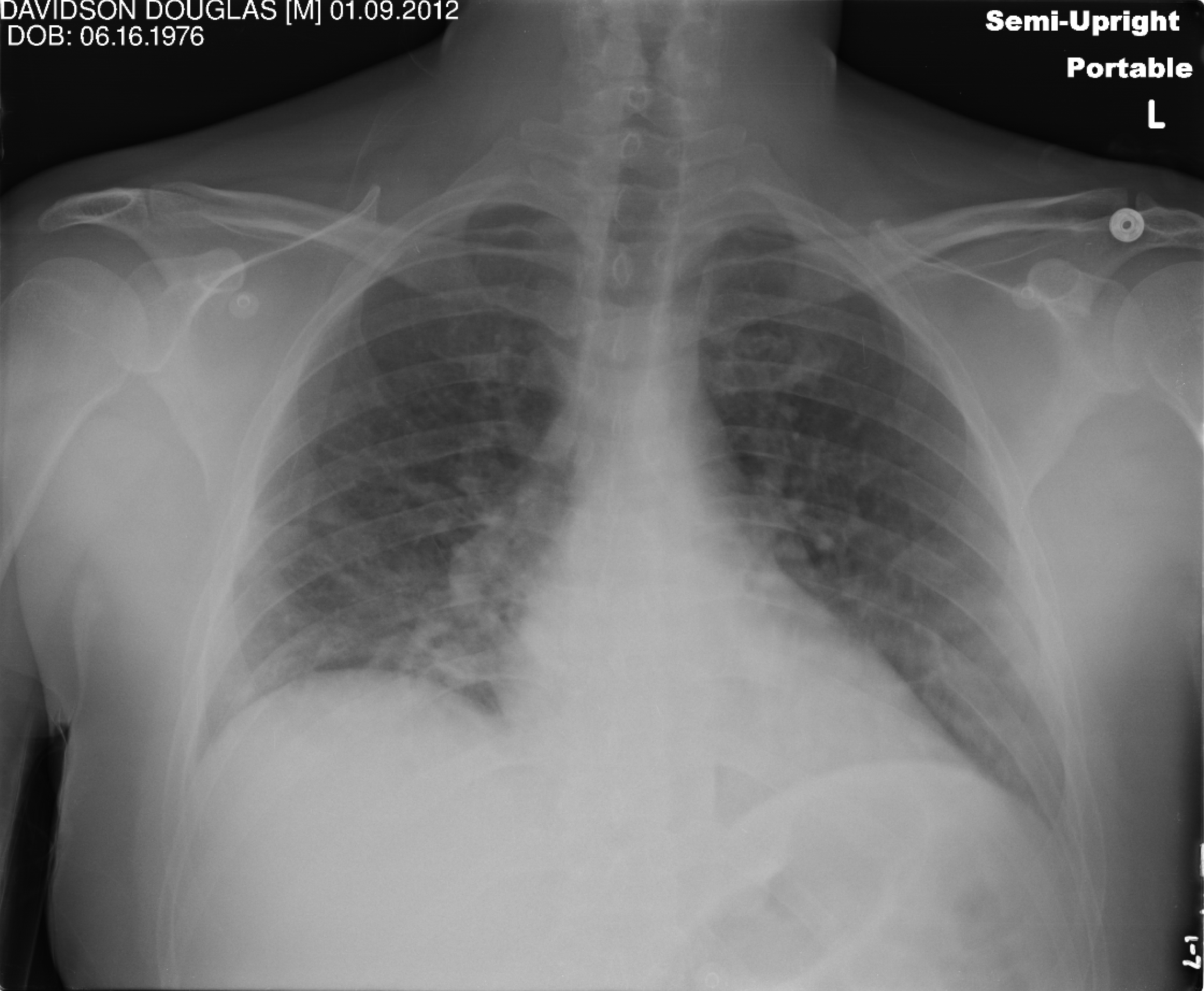 Features Image